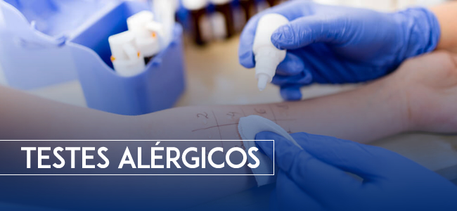 Testes Alérgicos Testes Alérgicos